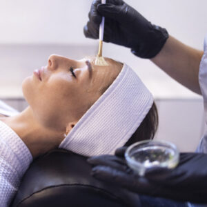 Chemical Peel Consent Template