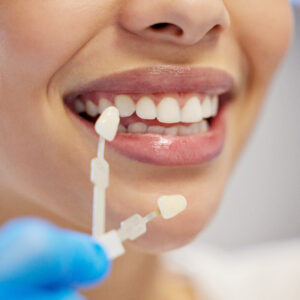 Home Tooth Whitening Consent Template