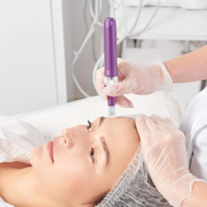 Microneedling (with or without PRP) Consent Template