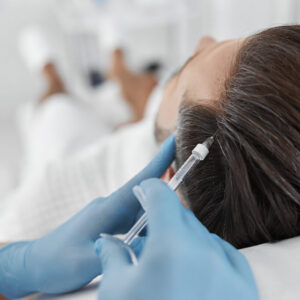PRP For Hair Loss Consent Template