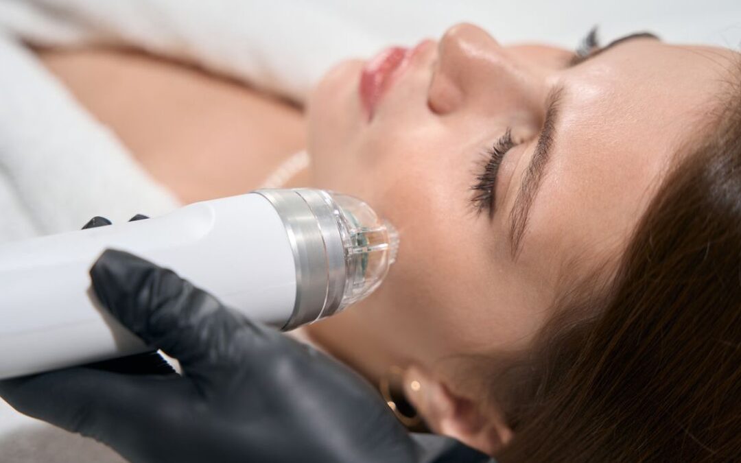 FDA Issues Warning on Risks of RF Microneedling Treatments